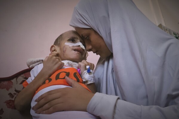 Nour al-Hams holds her 3-year-old nephew, Amr al-Hams, who lies in a hospital bed with brain damage caused by an Israeli strike on his family's tent in April, at Nasser Hospital in Khan Younis, Gaza Strip, Wednesday, June 25, 2025. (AP Photo/Mariam Dagga)