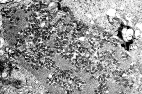 This undated electron microscope image provided by the Centers for Disease Control and Prevention shows rabies virions, dark and bullet-shaped, within an infected tissue sample. (F. A. Murphy/CDC via AP, File)