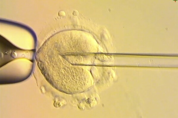 This image from video provided by the Newcastle Fertility Centre shows a nuclear genome from an egg carrying a mitochondrial DNA mutation being inserted into an egg donated by an unaffected woman. (Newcastle Fertility Centre, Newcastle Hospitals NHS Foundation Trust via AP)